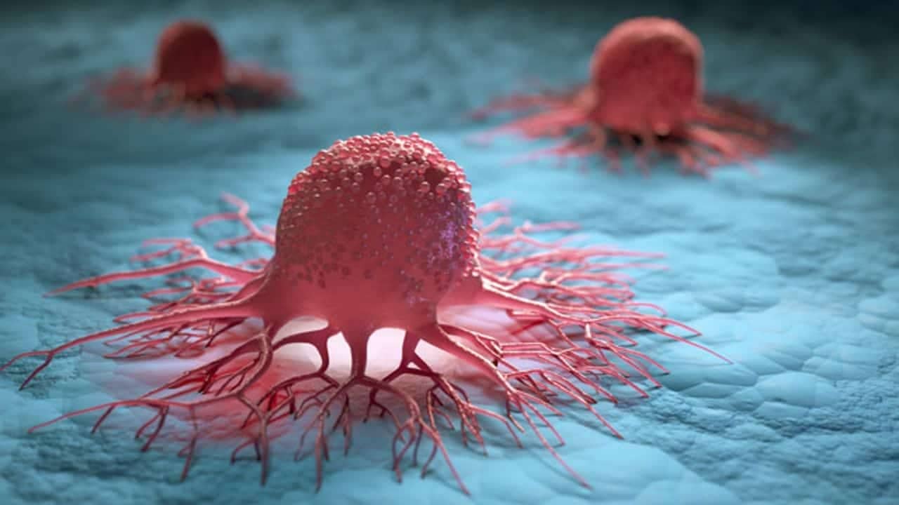 هل يسبب الاكتئاب والقلق الإصابة بالسرطان؟