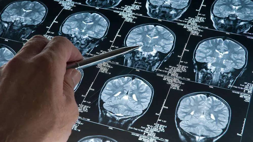 دراسة من هارفارد: مهنتك قد تصيبك بمرض الزهايمر