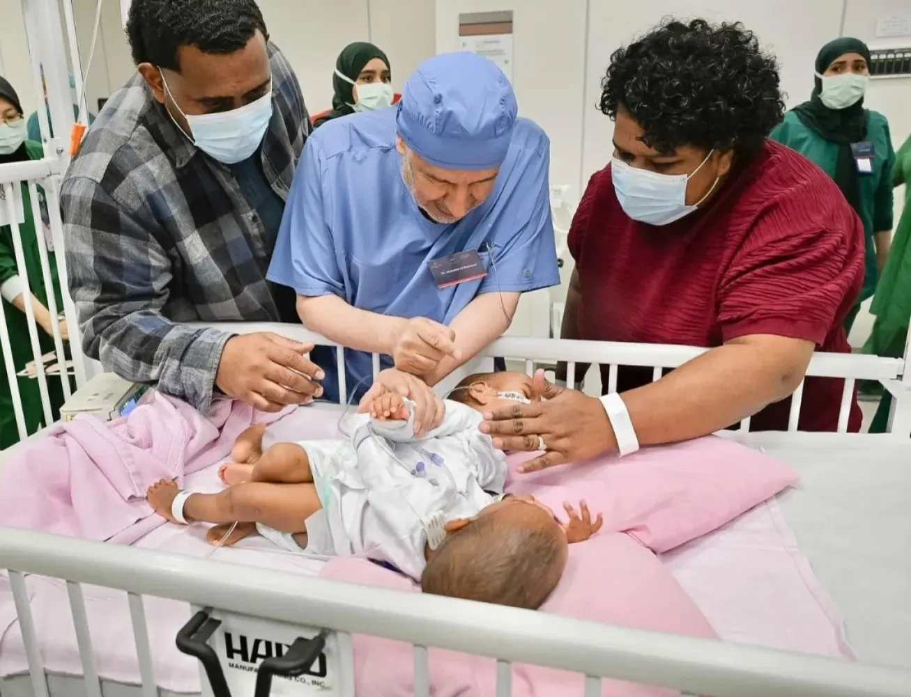 التوائم الملتصقة.. كيف تتكون ولماذا يجهل العلماء أسبابها؟