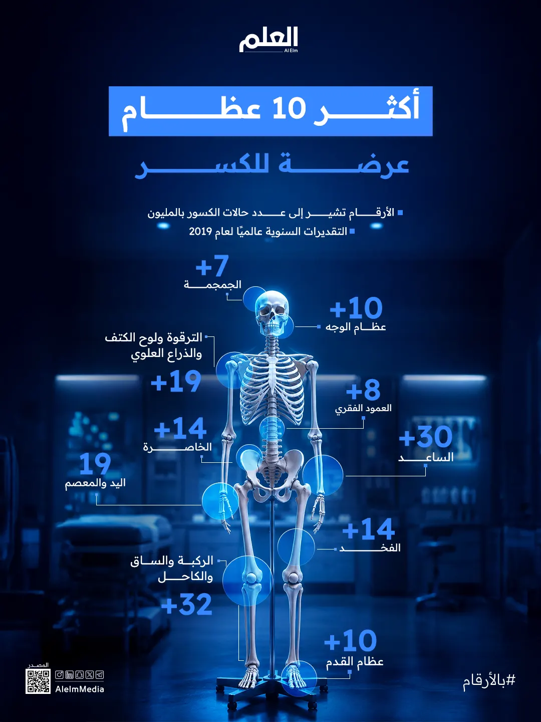 إنفوجرافيك| ملايين الكسور سنويًا.. ما العظام الأكثر عُرضة؟