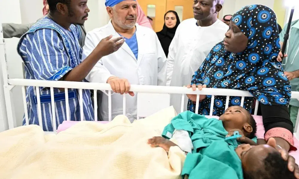 نجاح فصل التوأم السيامي البوركيني تأكيدًا للريادة السعودية بهذا المجال