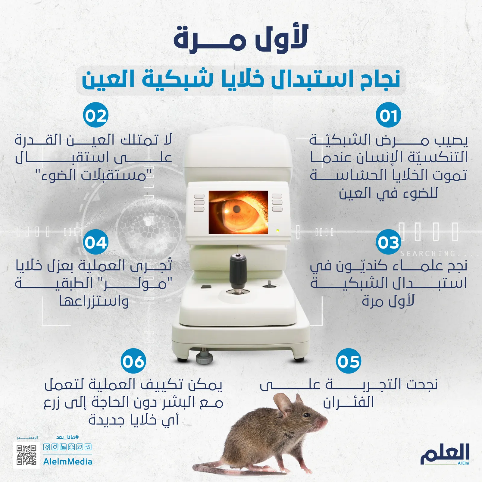 لأول مرة.. نجاح استبدال خلايا شبكية العين