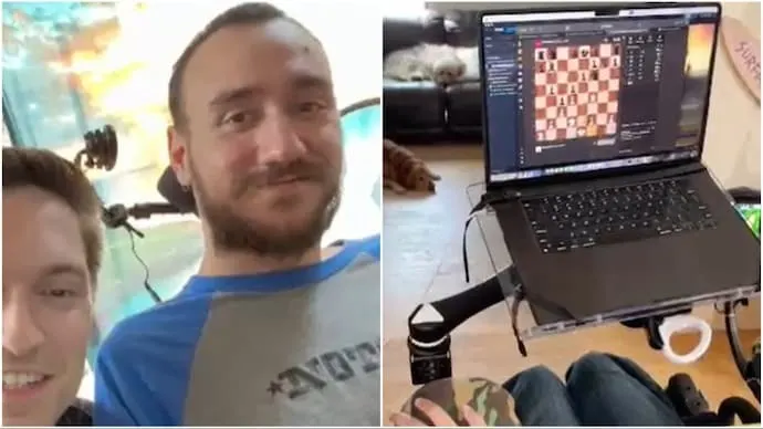 بالفيديو.. أول شخص يتحكم في الكمبيوتر بأفكاره بعدما زرع شريحة Neuralink