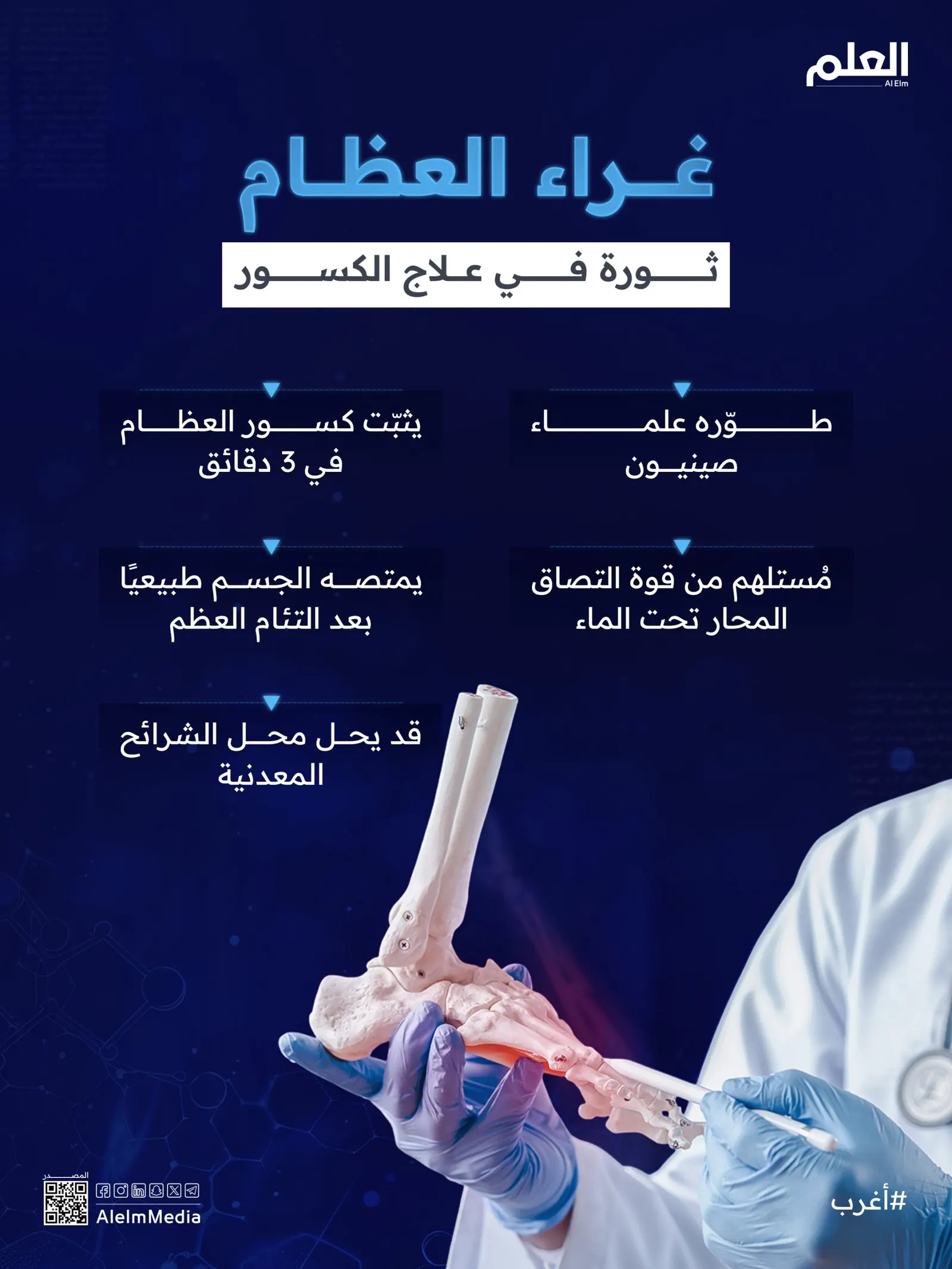 إنفوجرافيك| غراء العظام.. ثورة في علاج الكسور