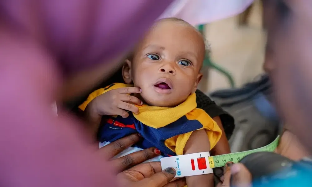 3 ملايين طفل مُهدّد.. التقصير الدولي يفاقم كارثة سوء التغذية في السودان