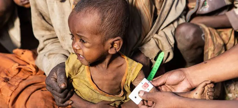الجوع العالمي يتفاقم.. 266 مليون شخص يواجهون أزمة غذائية