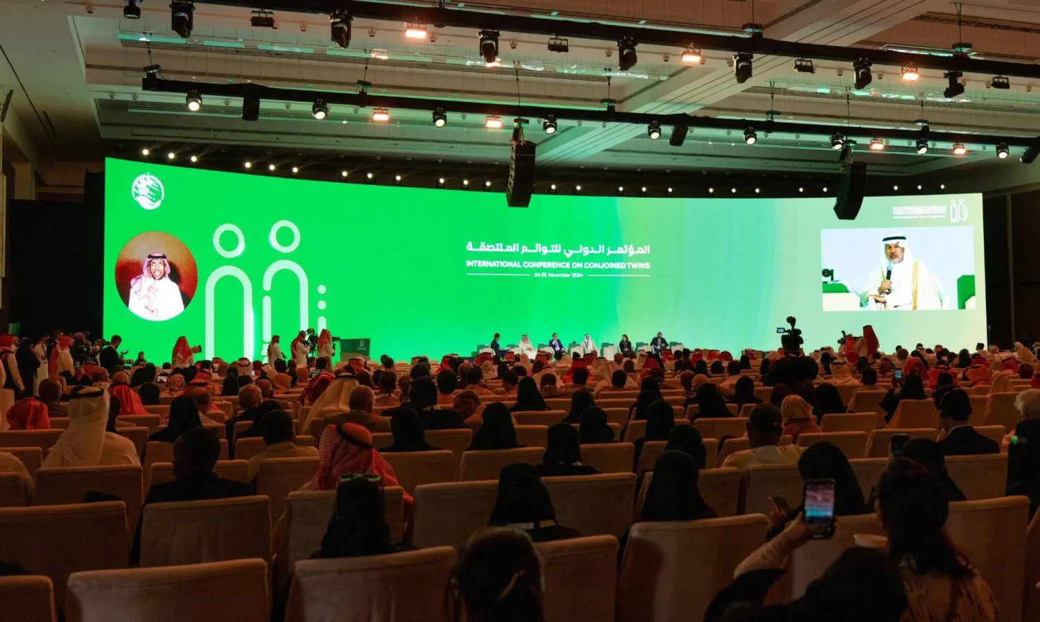 المؤتمر الدولي للتوائم الملتصقة.. 30 عامًا من العطاء الإنساني