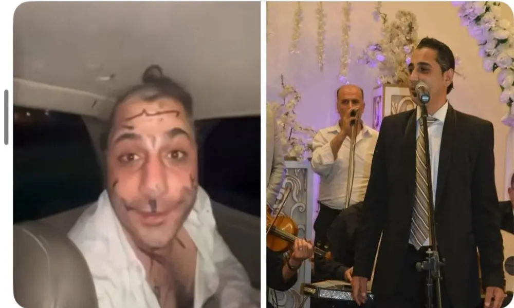 عمر خيري.. القصة الكاملة للاعتداء على الفنان السوري