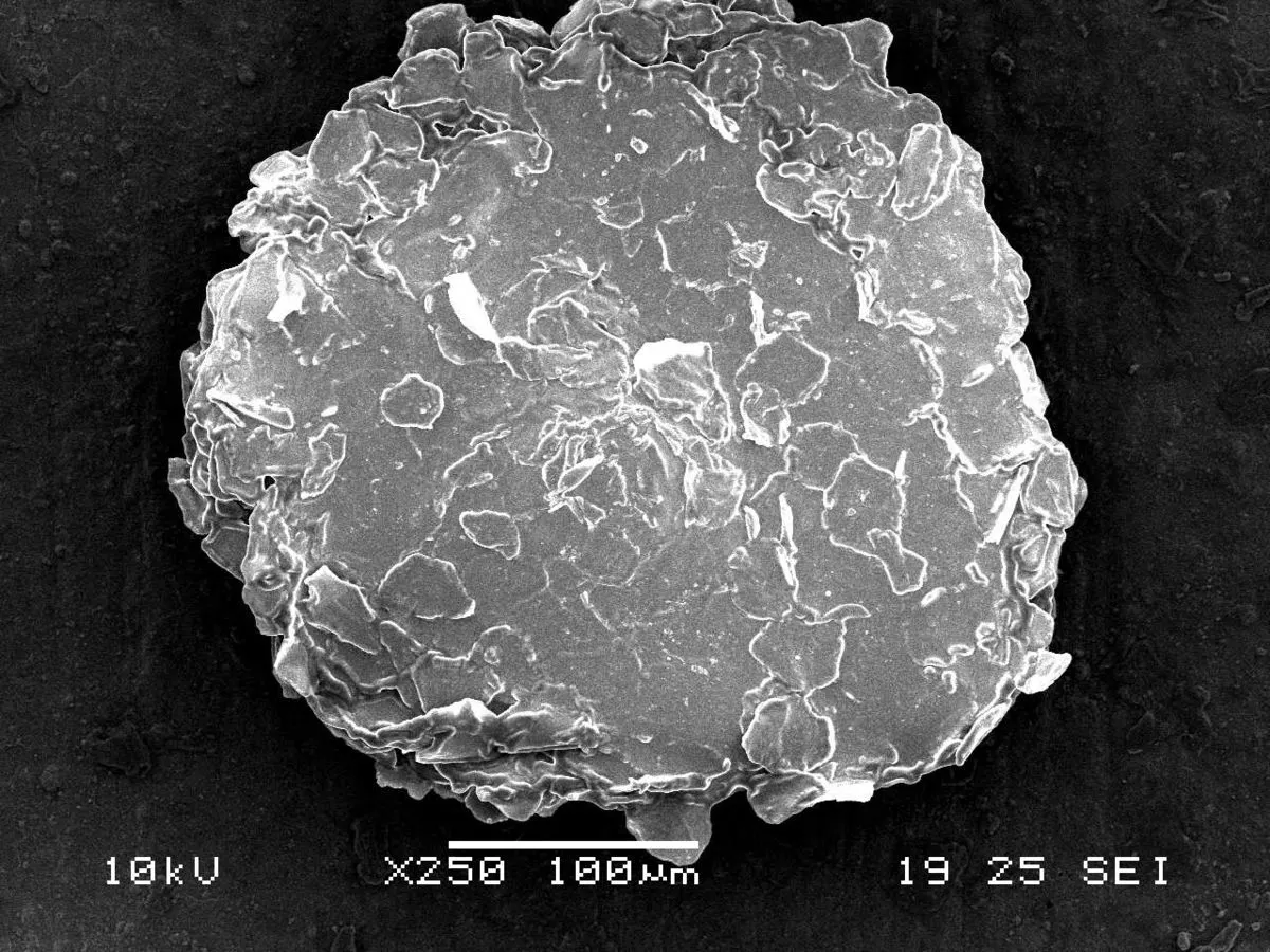 الرجال أكثر عُرضة للإصابة بها.. كل شيء عن قشرة فروة الرأس