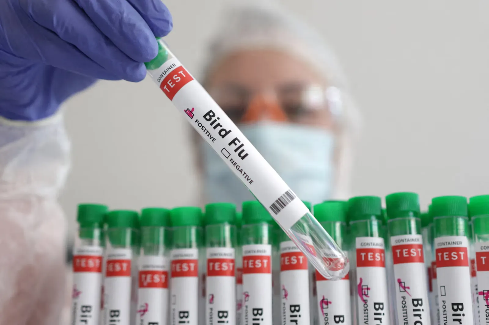 بعد وفاة أول مصاب به.. مخاوف من جائحة إنفلونزا الطيور H5N2