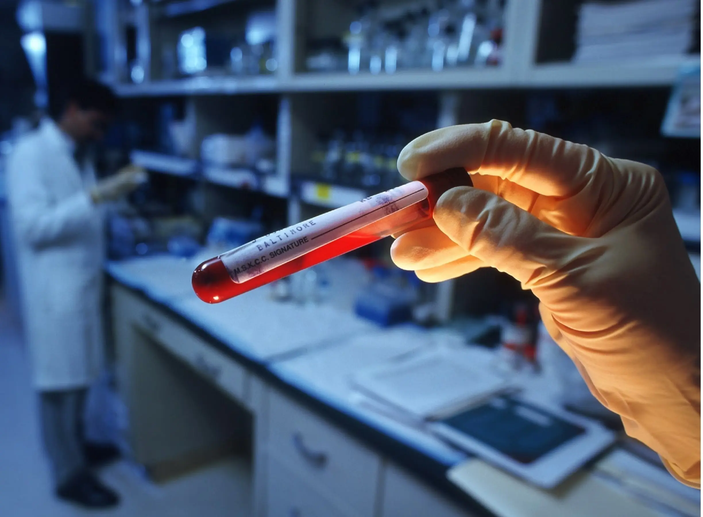 علماء يطورون أداة تكشف السرطان بقطرة دم!