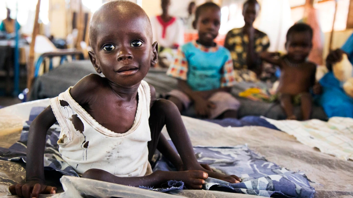 التغذية في جنوب السودان